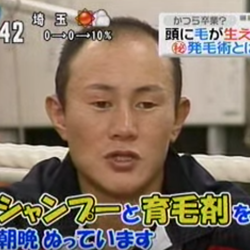 カツラボクサーとして時の人となった！『小口雅之選手』の現在は？！