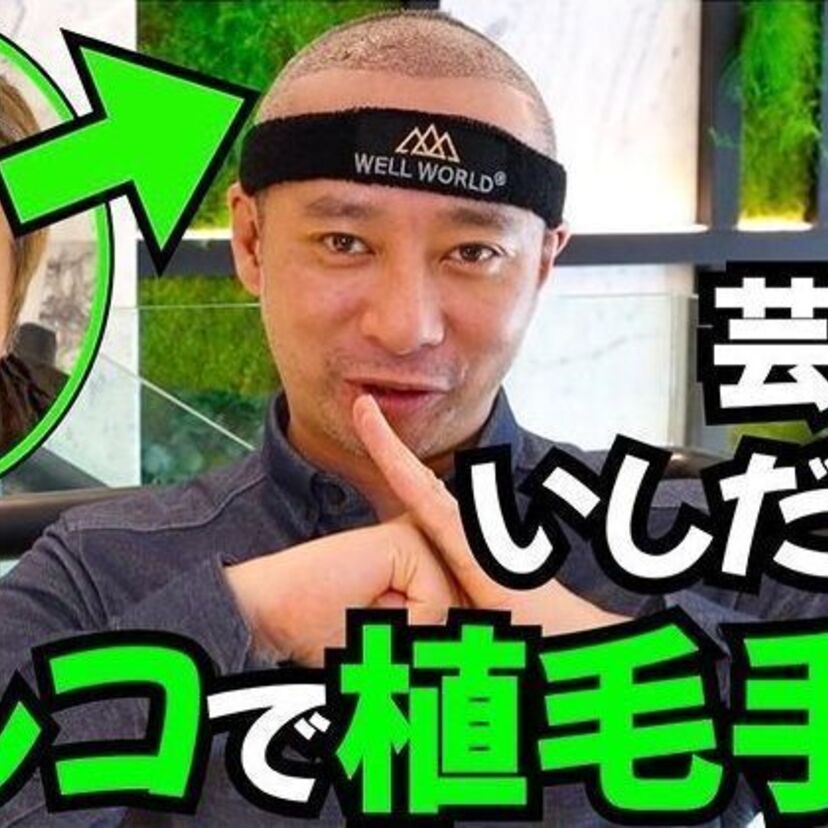俳優・いしだ壱成（47）がトルコで「植毛手術」を受けたと話題に！写真と動画が公開中！！